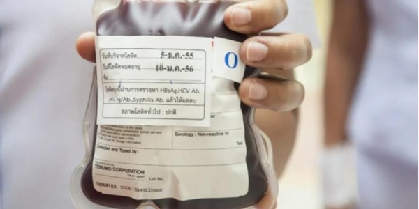 冷鏈不干膠紙標簽對油墨、加工和運輸的要求